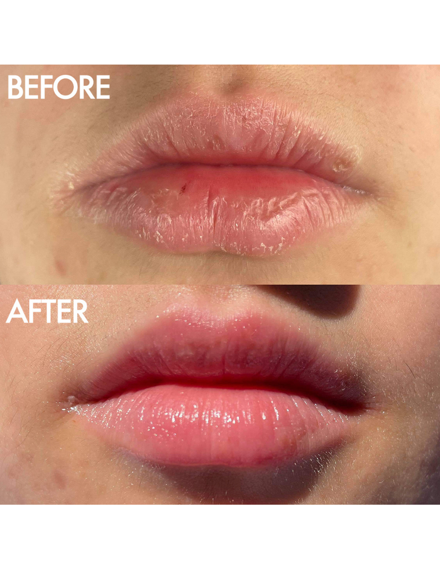 Before and After 101 Ointment