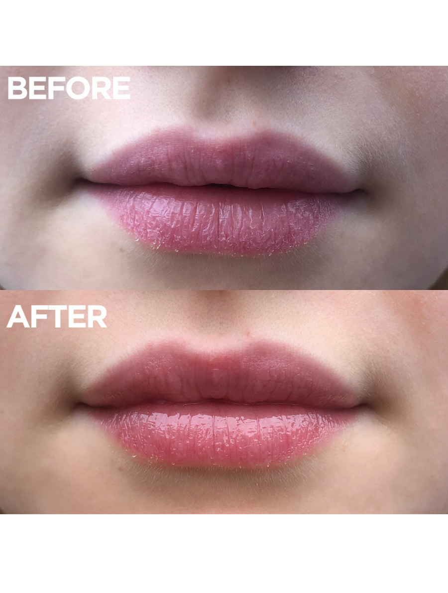 Before & After