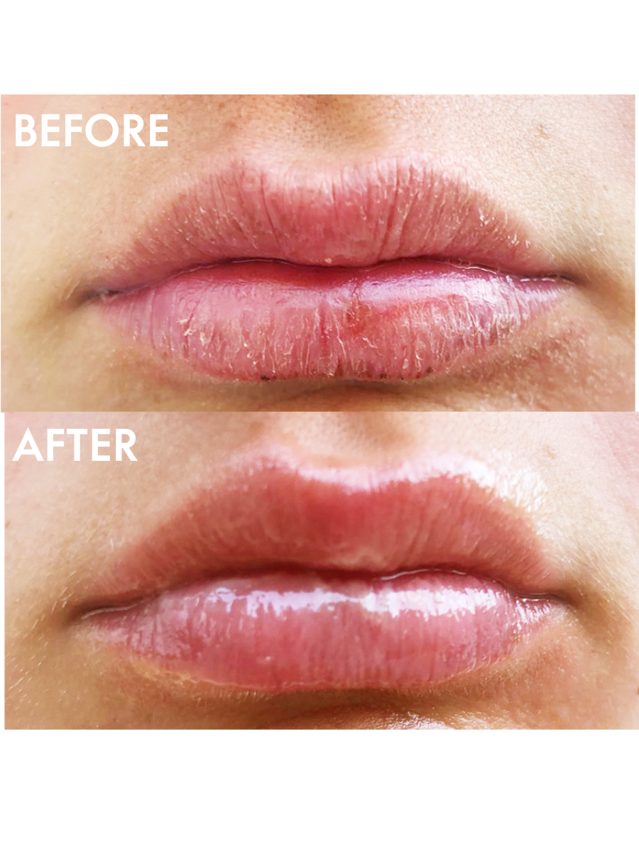 Before & After