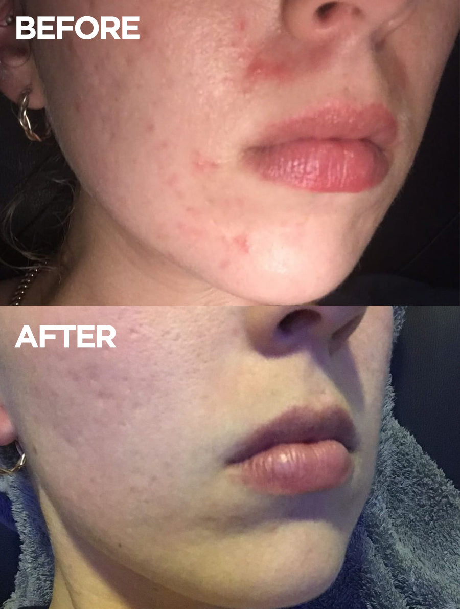 Face Base Lanolin + Vitamin E Day Cream
