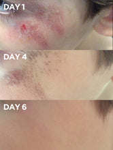 Load image into Gallery viewer, Before &amp; After of Child&#39;s Graze using Golden Dry Skin Miracle Salve
