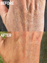 Load image into Gallery viewer, Before &amp; After of Hand using Golden Dry Skin Miracle Salve
